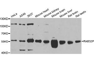Western blot analysis of extracts of various cell lines, using RAB3IP antibody. (RAB3IP antibody)