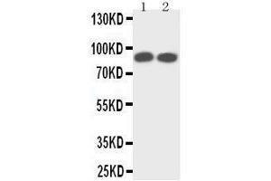 Anti-TrkA antibody,  Western blotting Lane 1: Rat Brain Tissue Lysate Lane 2: Mouse Brain Tissue Lysate (TRKA antibody  (N-Term))