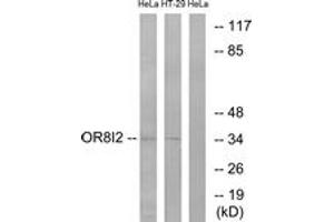 Western blot analysis of extracts from HeLa/HT-29 cells, using OR8I2 Antibody.
