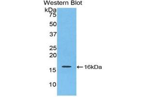 Detection of Recombinant IL16, Mouse using Polyclonal Antibody to Interleukin 16 (IL16) (IL16 antibody  (AA 1203-1322))