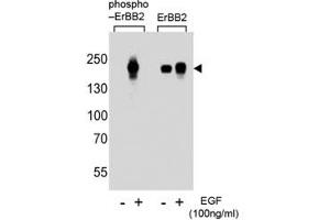 Western blot analysis of extracts from A431 cells, untreated or treated with EGF at 100ng/ml, using phospho-ErBB2 antibody (left) or nonphos-ErBB2 antibody (right).