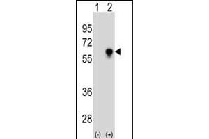 Western blot analysis of CDC25C (arrow) using CDC25C Antibody (ABIN1539792 and ABIN2843765). (CDC25C antibody)