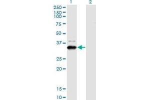 Western Blot analysis of ZNF365 expression in transfected 293T cell line by ZNF365 monoclonal antibody (M03), clone 2E3. (ZNF365 antibody  (AA 147-219))
