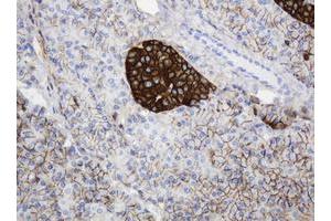 Image no. 1 for anti-CD99 (CD99) antibody (ABIN1497383) (CD99 antibody)