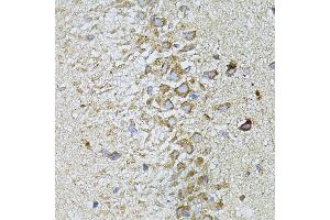 Immunohistochemistry of paraffin-embedded Rat brain using MTNR1A antibody (ABIN6128254, ABIN6144165, ABIN6144166 and ABIN6216865) at dilution of 1:100 (40x lens). (Melatonin Receptor 1A antibody  (AA 281-350))