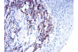 Immunohistochemistry (IHC) image for anti-Cathepsin D (CTSD) (AA 1-100) antibody (ABIN5542294)