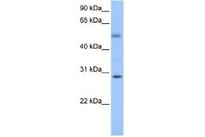 C17ORF81 antibody used at 1 ug/ml to detect target protein. (Retinoic Acid Induced 12 (RAI12) (C-Term) antibody)