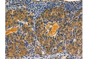 ABIN6261604 and ABIN6266802 at 1/100 staining Rat ovarian tissue by IHC-P.