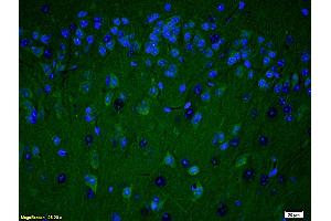 Formalin-fixed and paraffin embedded rat brain labeled with Anti PARP (N-Terminus) Polyclonal Antibody, Unconjugated (ABIN677903) at 1:200 followed by conjugation to the secondary antibody Goat Anti-Rabbit IgG, FITC conjugated used at 1:200 dilution for 40 minutes at 37°C and DAPI (PARP1 antibody  (AA 201-300))