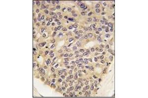 Immunohistochemistry (IHC) image for anti-PTEN Induced Putative Kinase 1 (PINK1) antibody (ABIN356391) (PINK1 antibody)