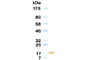 Western Blotting (WB) image for anti-Collagen, Type XVIII, alpha 1 (COL18A1) antibody (ABIN933868) (COL18A1 antibody)