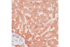 Immunohistochemistry of paraffin-embedded human liver using  antibody (ABIN6131192, ABIN6137264, ABIN6137265 and ABIN6215207) at dilution of 1:100 (40x lens). (ATG5 antibody  (AA 28-275))