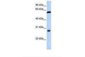 Image no. 1 for anti-Adrenocortical Dysplasia Homolog (ACD) (AA 398-447) antibody (ABIN6739073) (ACD antibody  (AA 398-447))
