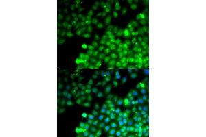 Immunofluorescence analysis of MCF7 cells using TAGLN2 antibody. (TAGLN2 antibody  (AA 1-199))