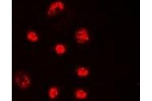 Immunofluorescent analysis of Lupus La (pS366) staining in HeLa cells. (Lupus La (C-Term), (pSer366) antibody)