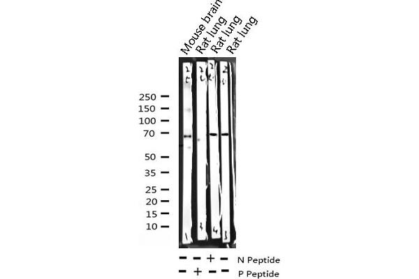 SYK antibody  (pTyr525)