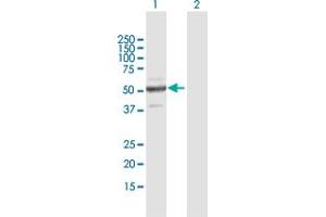 Western Blot analysis of ZNF772 expression in transfected 293T cell line by ZNF772 MaxPab polyclonal antibody.