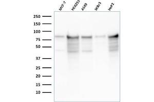 Western Blot Analysis of MCF-7, HEK-293, A549, SKBr3, HeP2 cell lysates using MCM7 Recombinant Mouse Monoclonal Antibody (rMCM7/1468). (Recombinant MCM7 antibody  (AA 195-319))