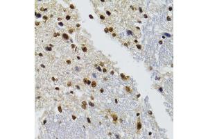 Immunohistochemistry of paraffin-embedded mouse brain using BAZ1B antibody. (BAZ1B antibody)