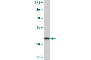 Western Blot detection against Immunogen (33. (XAGE2 antibody  (AA 44-111))