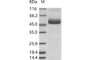 Zika Virus NS1 (ZIKV NS1) protein (His tag)
