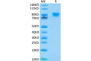 Human B7-H2 on Tris-Bis PAGE under reduced condition. (ICOSLG Protein (AA 19-258) (Fc Tag))