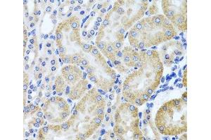 Immunohistochemistry of paraffin-embedded Mouse kidney using HDAC6 Polyclonal Antibody at dilution of 1:100 (40x lens). (HDAC6 antibody)