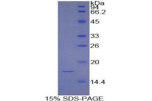 SDS-PAGE analysis of Cow HIF1a Protein.