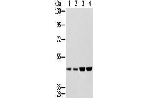 Western Blotting (WB) image for anti-Sjogren Syndrome Antigen B (SSB) antibody (ABIN2427328) (SSB antibody)