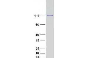 Validation with Western Blot (RC3H1 Protein (Myc-DYKDDDDK Tag))