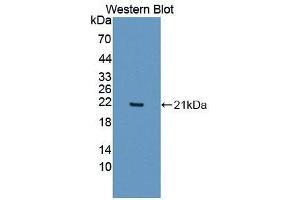 Figure. (IL1F9 antibody  (AA 1-158))