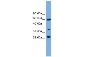 Western Blot showing TRAPPC5 antibody used at a concentration of 1-2 ug/ml to detect its target protein. (TRAPPC5 antibody  (N-Term))