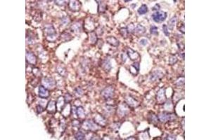 Immunohistochemistry (IHC) image for anti-Synovial Apoptosis Inhibitor 1, Synoviolin (SYVN1) (AA 586-617) antibody (ABIN3029082)