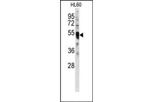 Image no. 1 for anti-Interferon Regulatory Factor 8 (IRF8) (C-Term) antibody (ABIN357999) (IRF8 antibody  (C-Term))