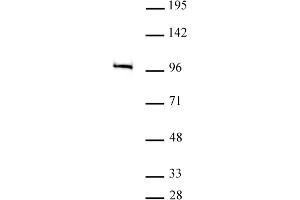 MED15 antibody (pAb) tested by Western blot. (MED15 antibody  (C-Term))