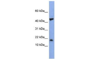 WB Suggested Anti-LSM1 Antibody Titration:  0. (LSM1 antibody  (Middle Region))