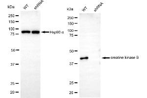 Western blotting analysis using creatine kinase B antibody (ABIN7798162).