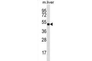 Western Blotting (WB) image for anti-Homeobox D10 (HOXD10) antibody (ABIN2996848) (HOXD10 antibody)