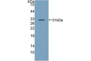 Detection of Recombinant PALLD, Human using Polyclonal Antibody to Palladin (PALLD) (PALLD antibody  (AA 1137-1383))