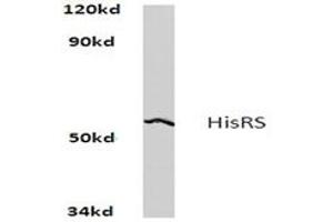 Image no. 1 for anti-Histidyl-tRNA Synthetase (HARS1) antibody (ABIN272164) (HARS1/Jo-1 antibody)