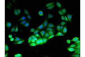 Immunofluorescent analysis of HepG2 cells using ABIN7163196 at dilution of 1:100 and Alexa Fluor 488-congugated AffiniPure Goat Anti-Rabbit IgG(H+L) (PIK3 gamma antibody  (Catalytic Subunit gamma))