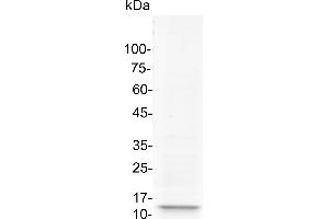 SDS-PAGE (SDS) image for Fibronectin Type III Domain Containing 5 (FNDC5) protein (ABIN7884377)