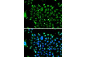 Immunofluorescence analysis of U2OS cells using NCOR1 antibody.