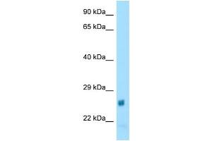 WB Suggested Anti-Naa60 Antibody Titration: 1. (NAT15 antibody  (N-Term))