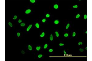 Immunofluorescence of monoclonal antibody to HMGB2 on HeLa cell. (HMGB2 antibody  (AA 1-195))