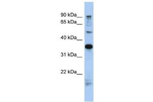 MGC70924 antibody used at 1 ug/ml to detect target protein. (PRR19 antibody  (N-Term))