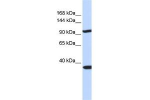 WB Suggested Anti-PAPPA2 Antibody Titration:  0. (PAPPA2 antibody  (N-Term))