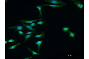 Immunofluorescence of purified MaxPab antibody to DTNBP1 on HeLa cell.