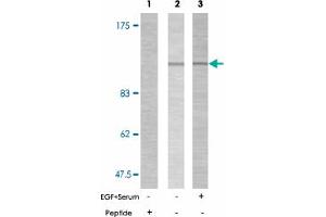 Western blot analysis of extracts from HepG2 cells (lane 1 and 2) and 293 cells (lane 3) using PTK2 (phospho Y925) polyclonal antibody . (FAK antibody  (pTyr925))