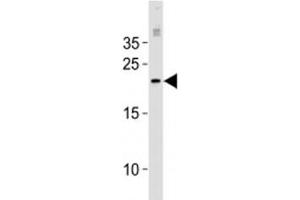 MGMT antibody western blot analysis in MCF-7 lysate. (MGMT antibody  (AA 1-30))